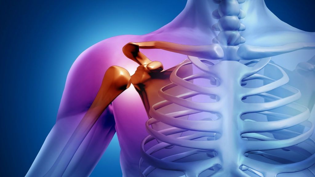 osteoartroz plechevogo sustava - Остеоартроз плечевого сустава. Причины и лечение